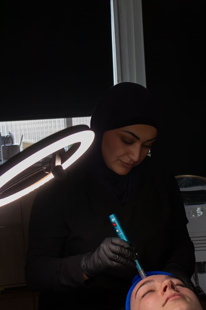 micro needling studio skin tournefeuille