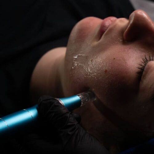 micro needling studio skin tournefeuille