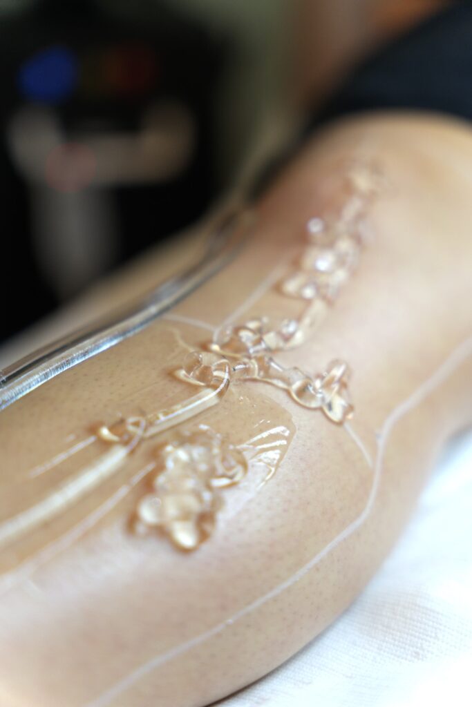 Soisublim, institut privé au Croisic. Epilation laser